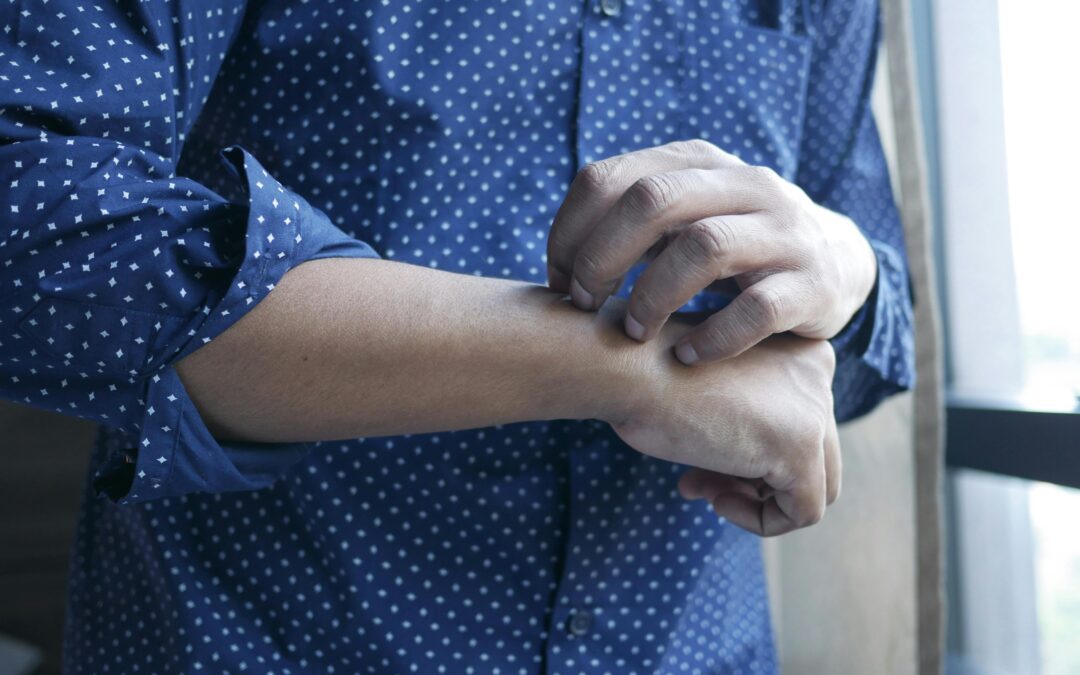 Experiencing Allergy Symptoms?Is Skin Prick Test the Right Choice in Dubai?